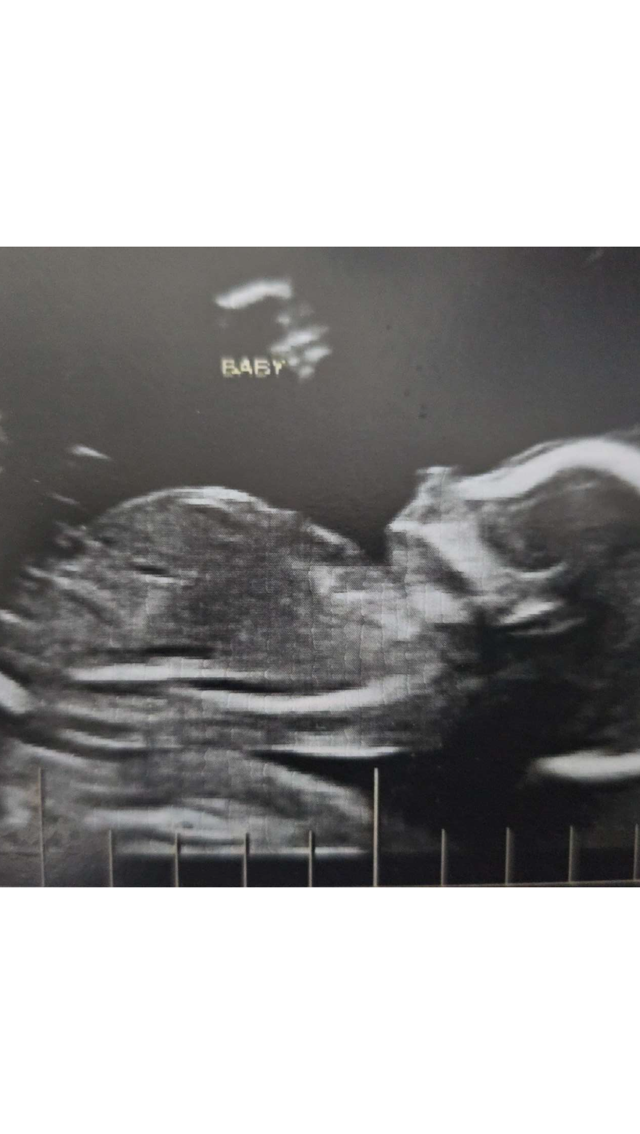 Pls help my baby girl get a safe start. photo