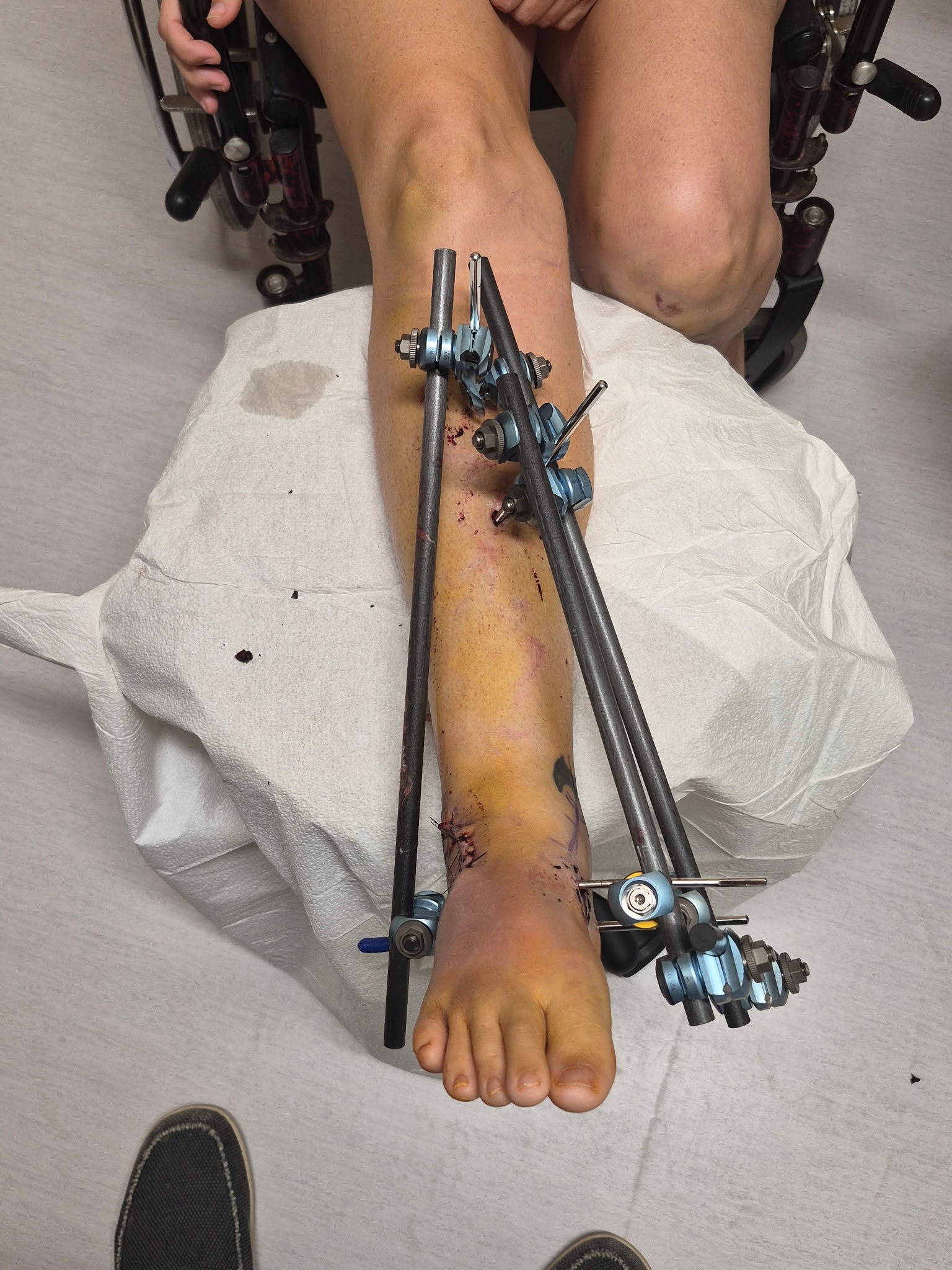 Care for Shannon and Darcy's Recovery Journey campaign photo, 2 of 8