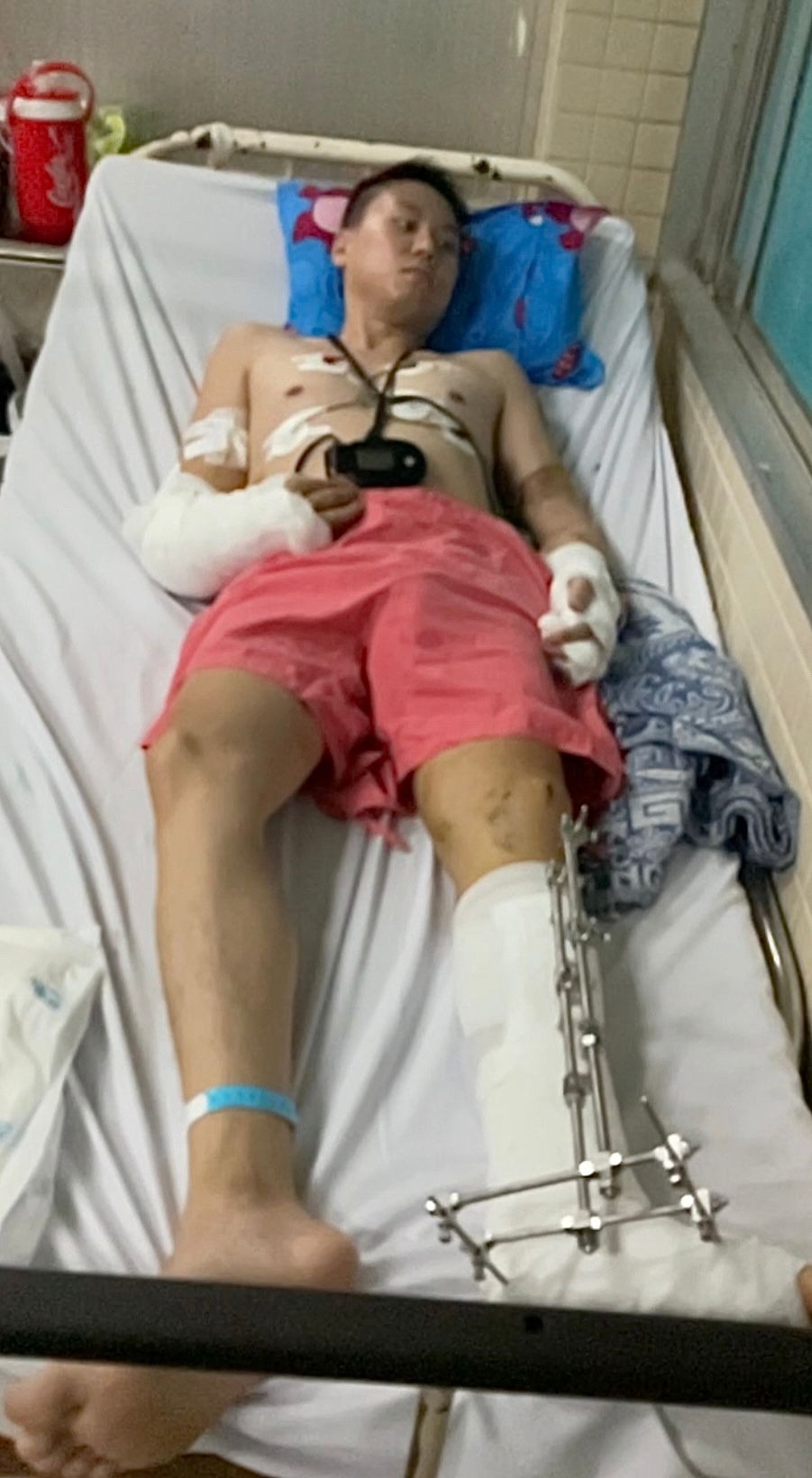 Brother injured in scooter accident campaign photo, 2 of 6