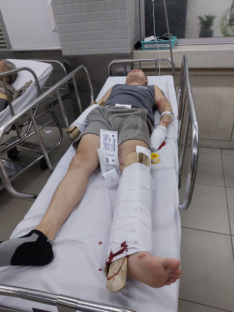 Brother injured in scooter accident campaign photo, 4 of 6