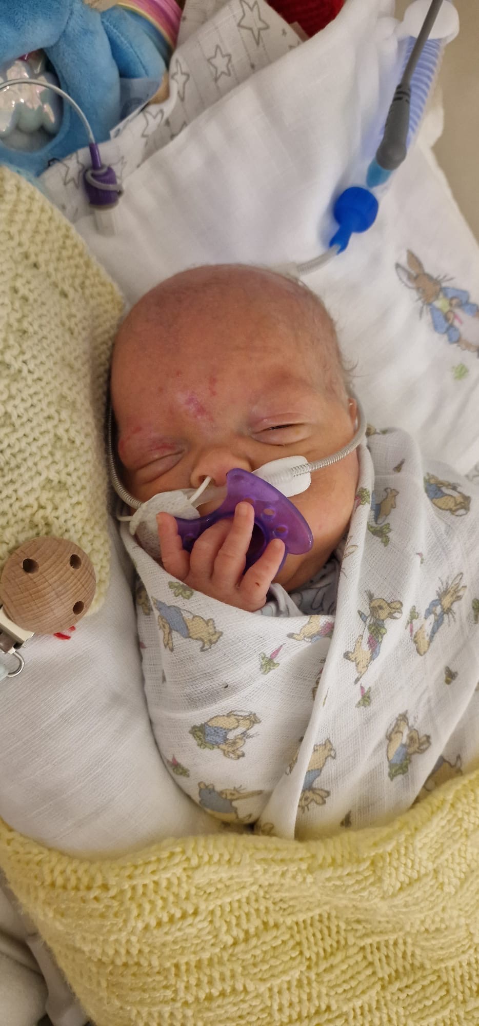 Help Luca Access Life-Changing Stem Cell Therapy campaign photo, 7 of 8