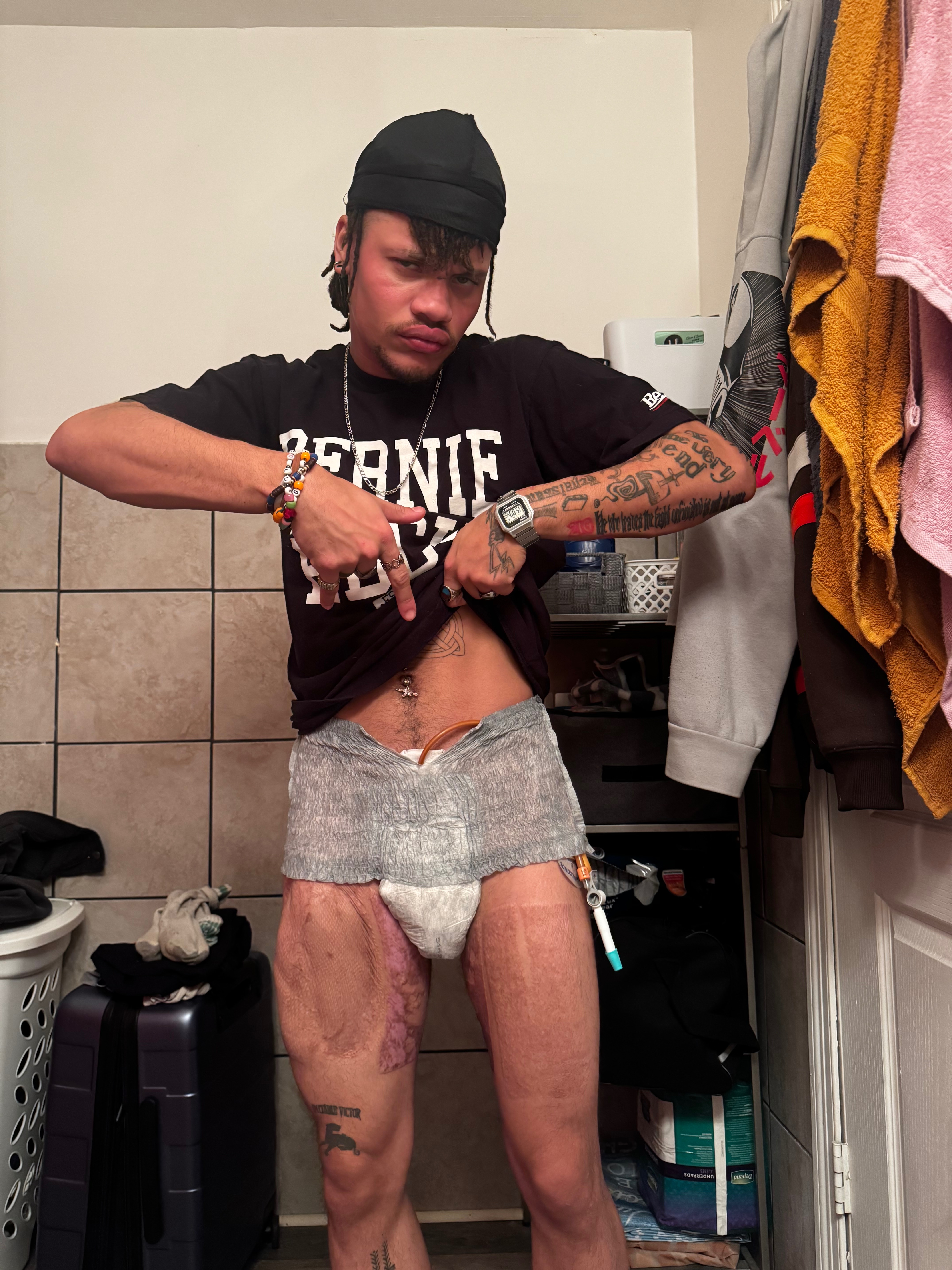 A young man pee, urethraplasty #3 campaign photo, 7 of 8
