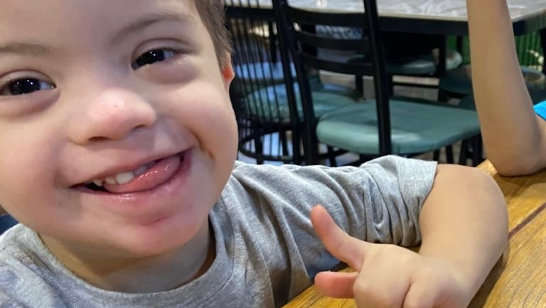 for the operation and separation of his fingers photo