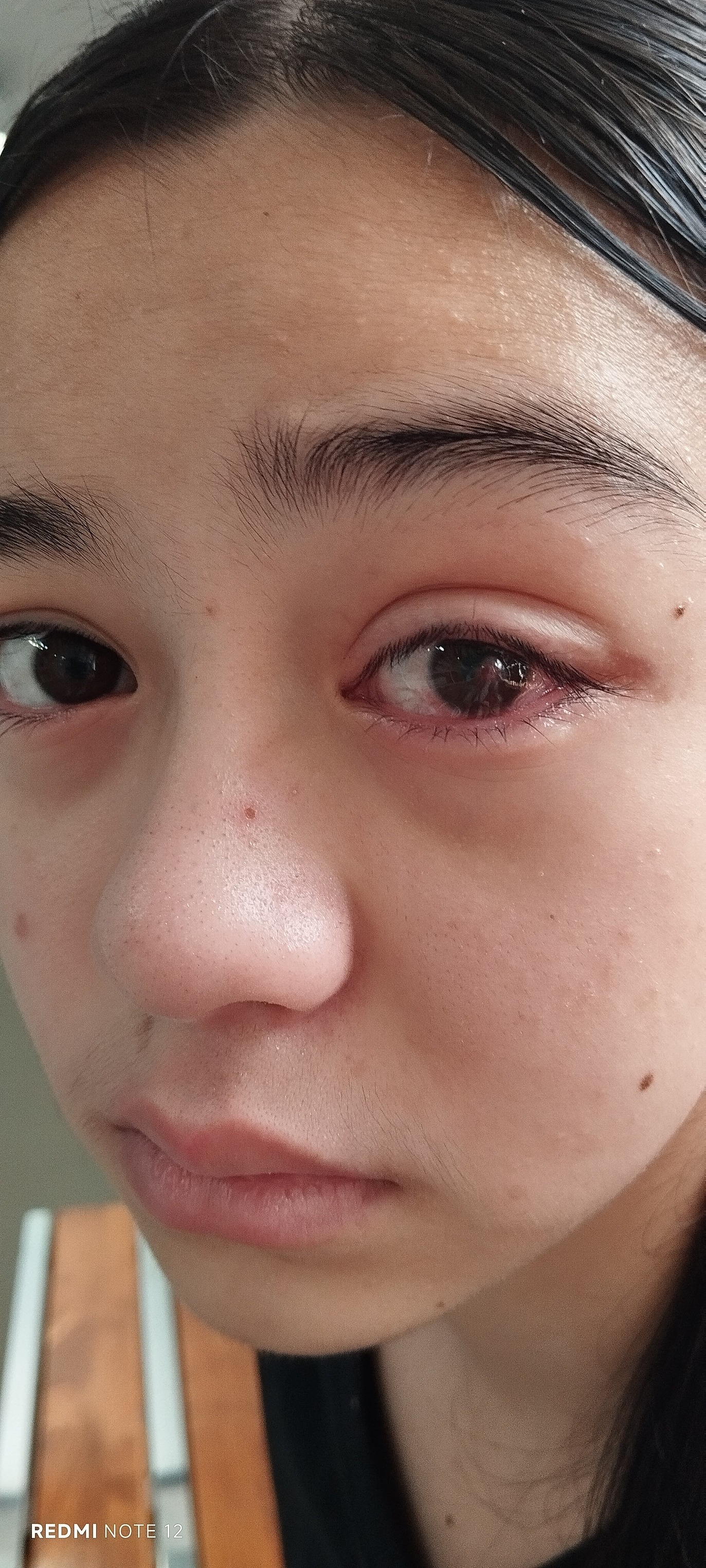 Help Our Refugee Family Cover Urgent Eye Treatment Costs campaign photo, 6 of 7