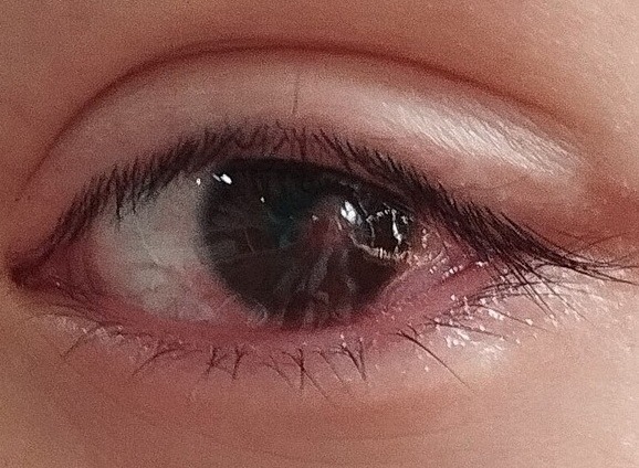 Help Our Refugee Family Cover Urgent Eye Treatment Costs campaign photo, 4 of 7