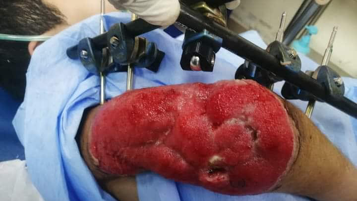 Help Kenan and Ahmad Heal and Rebuild photo