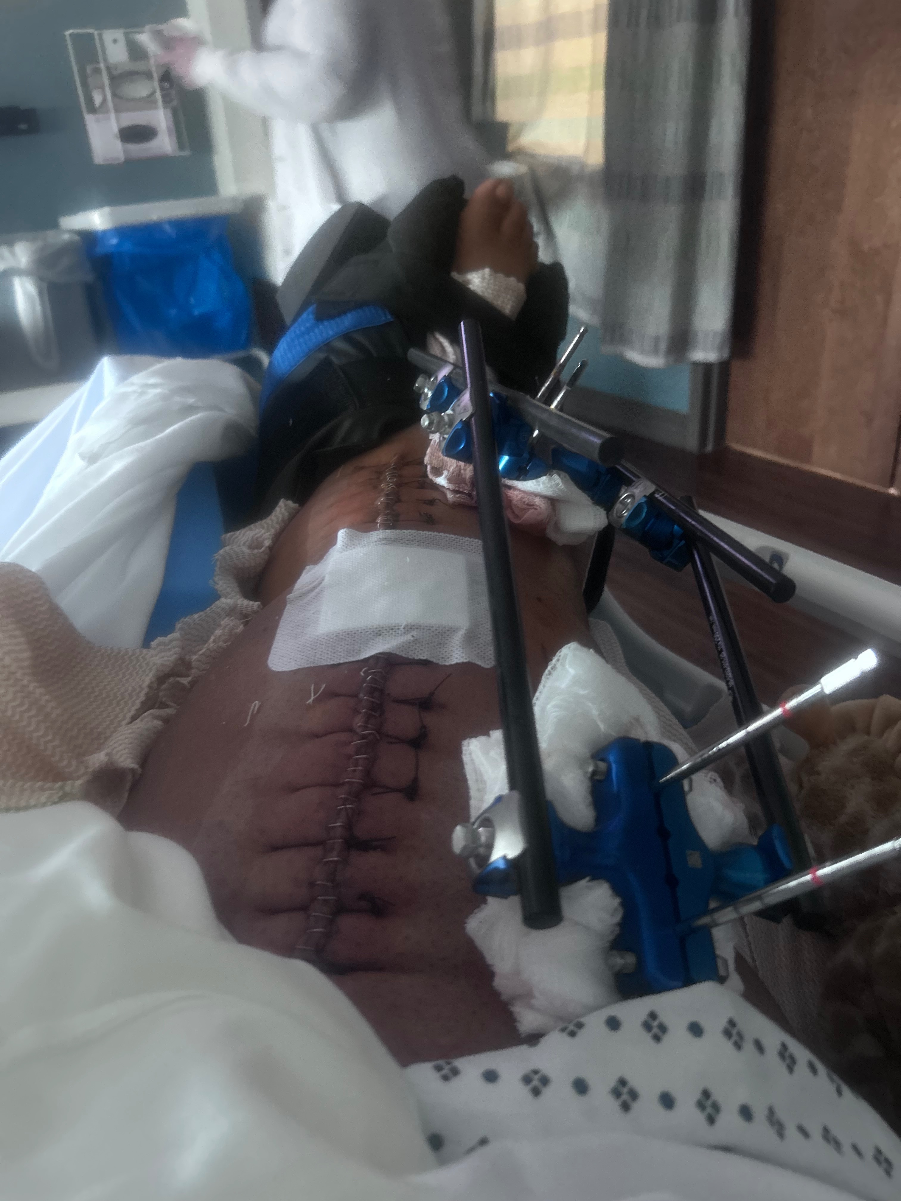 Support Teresa’s Journey to Recovery and Independence campaign photo, 4 of 5