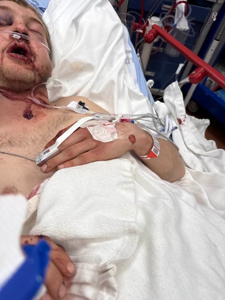 Help young Father through a life-changing accident campaign photo, 2 of 7