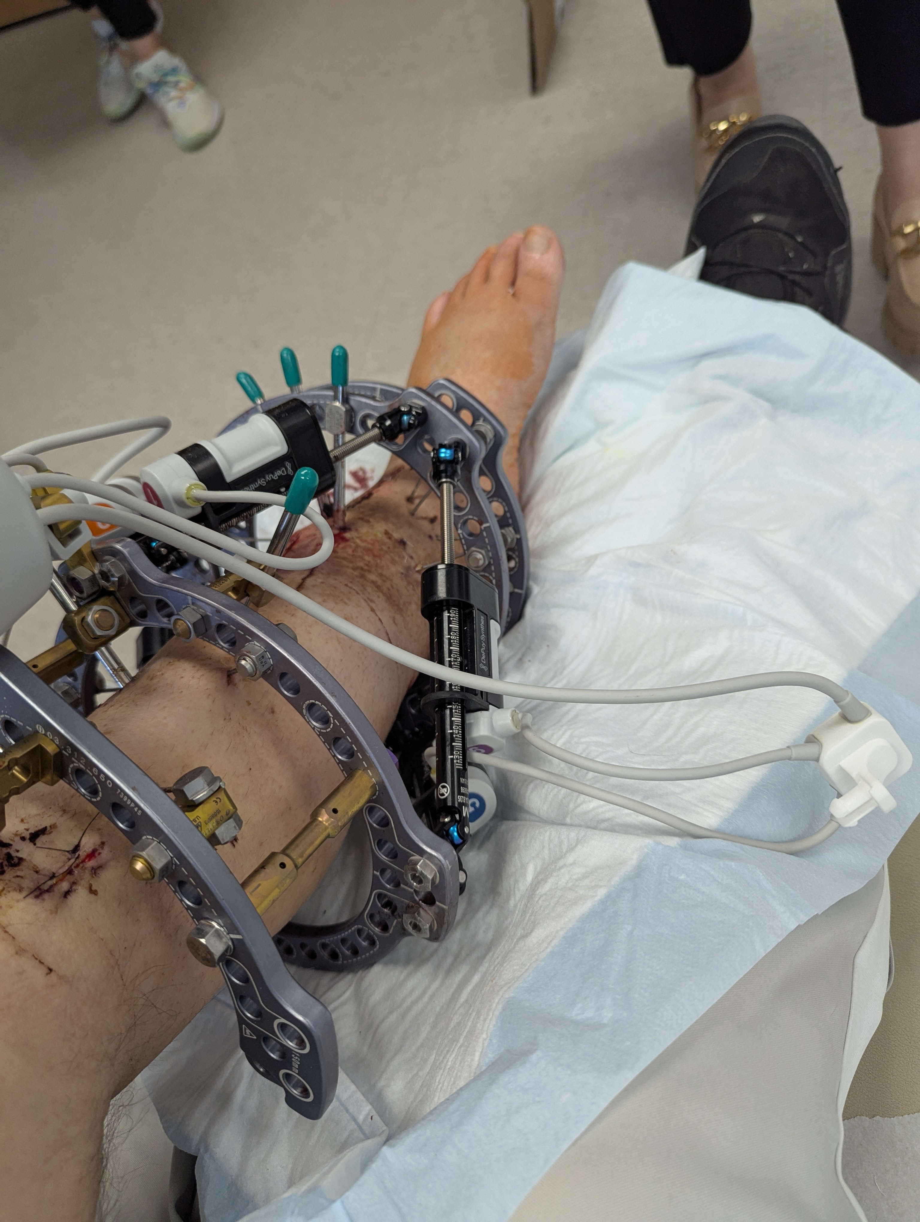 Help Robert's Family Find Stability After Medical Crisis campaign photo, 7 of 8