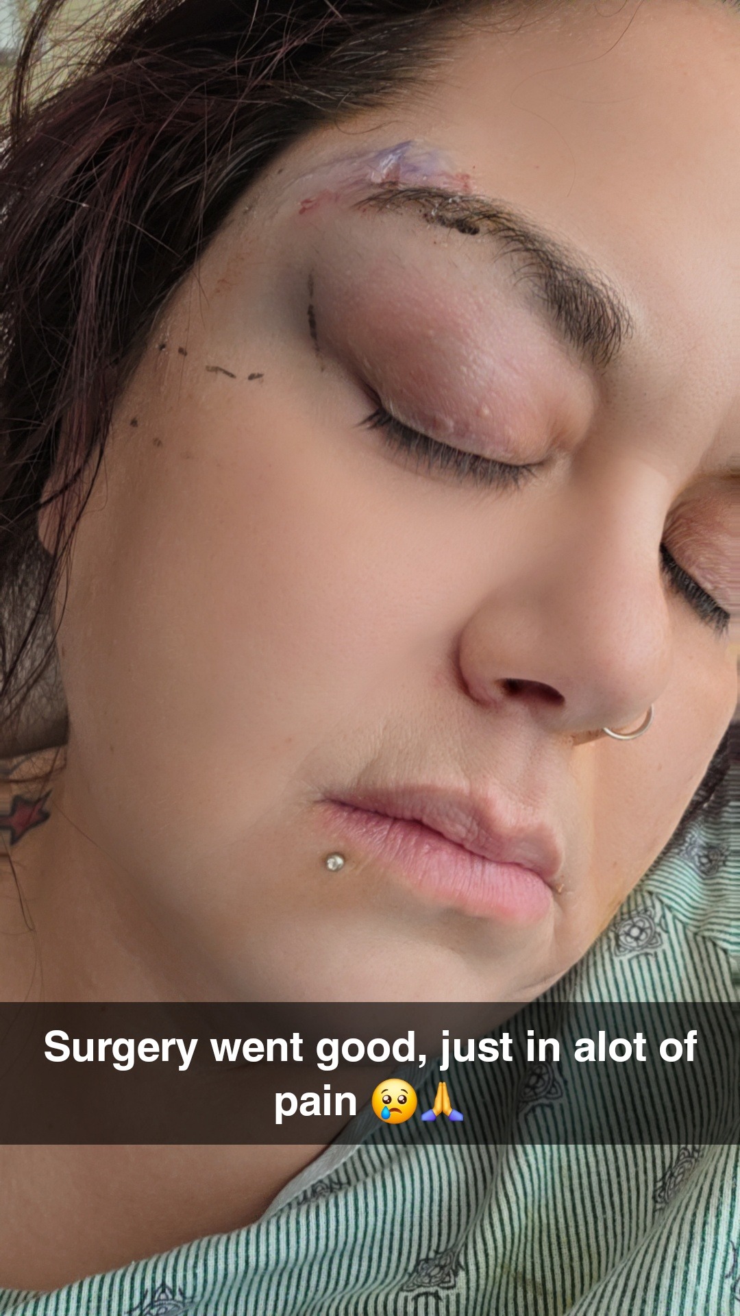 Support Jennifer's recovery after removal of tumor on skull campaign photo, 2 of 8