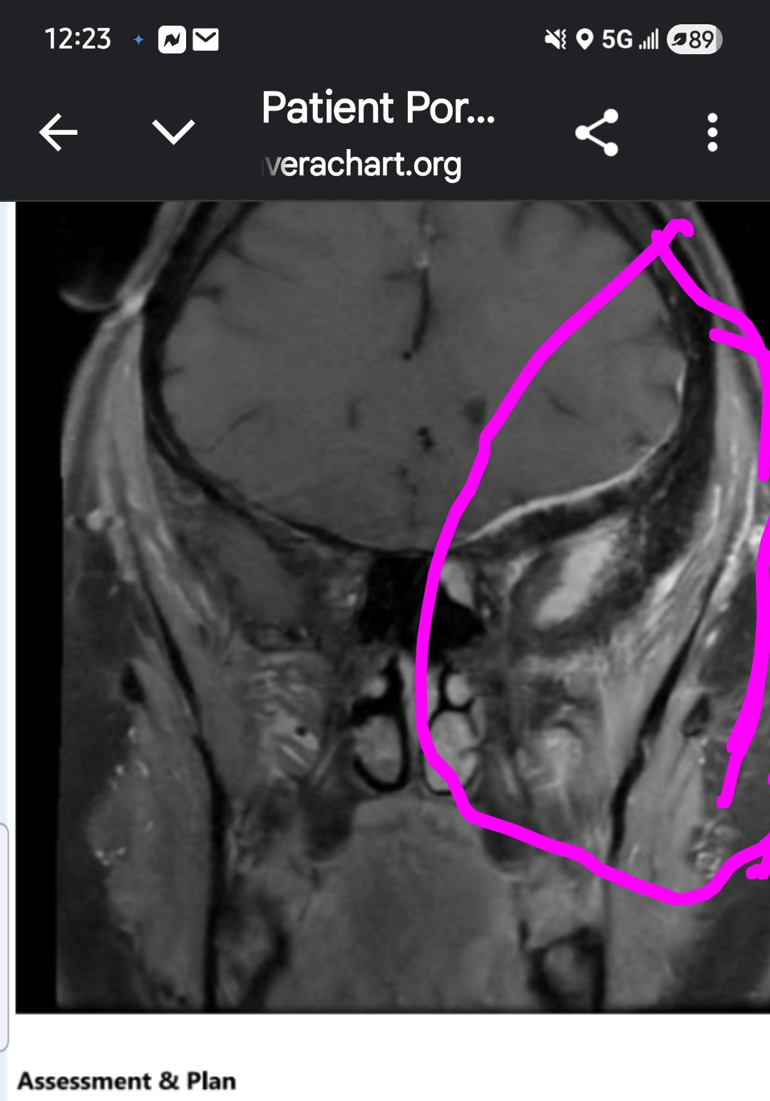 Support Jennifer's recovery after removal of tumor on skull campaign photo, 4 of 8