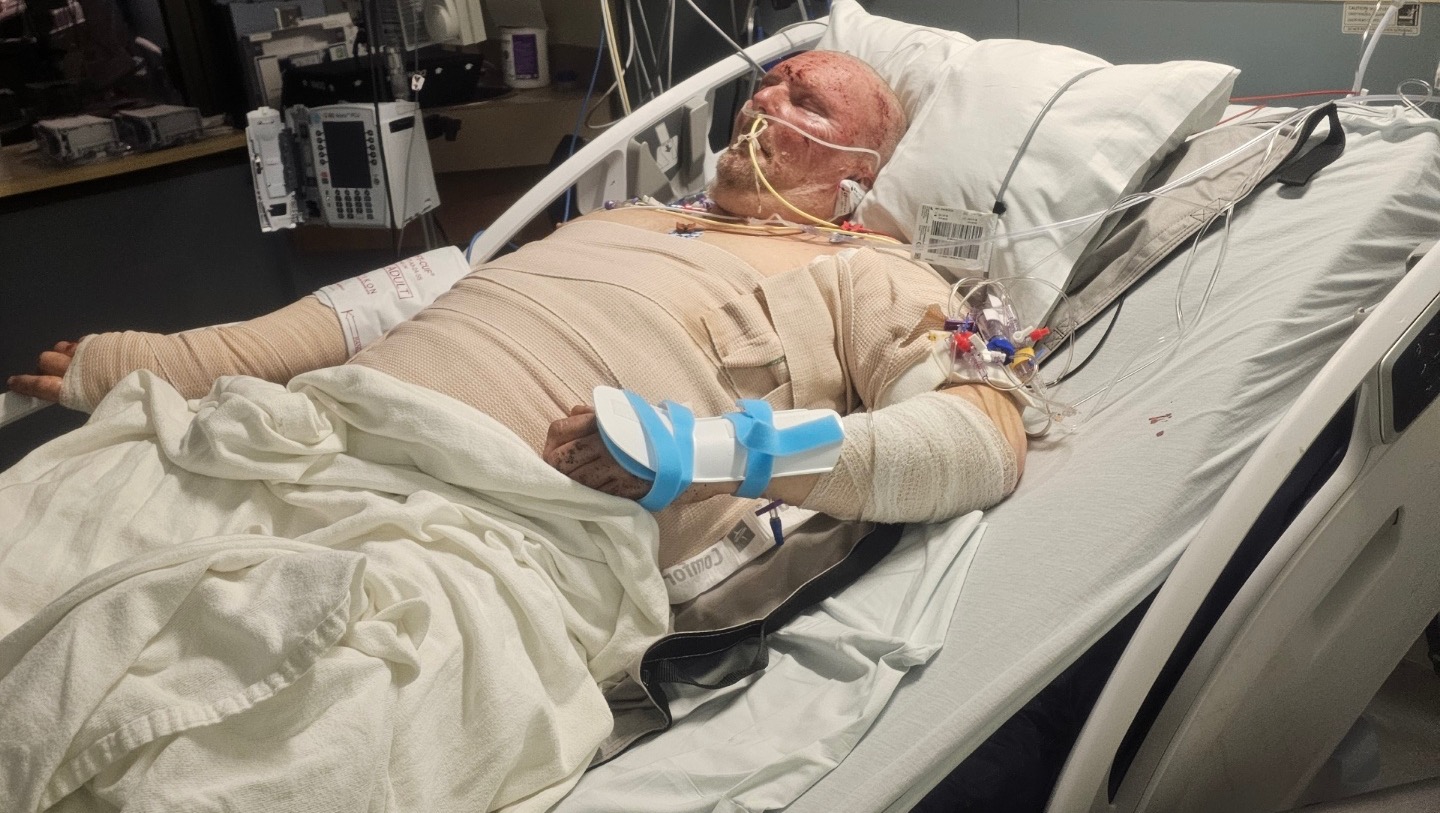 Fundraiser for redacted redacted by Kasey Collins : Joseph’s burn recovery