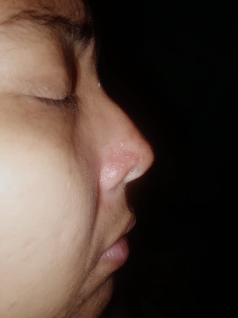 Help Gema With Needed Surgery Expenses campaign photo, 7 of 8