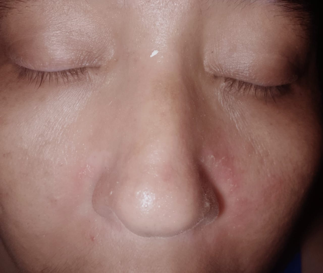 Help Gema With Needed Surgery Expenses campaign photo, 4 of 8