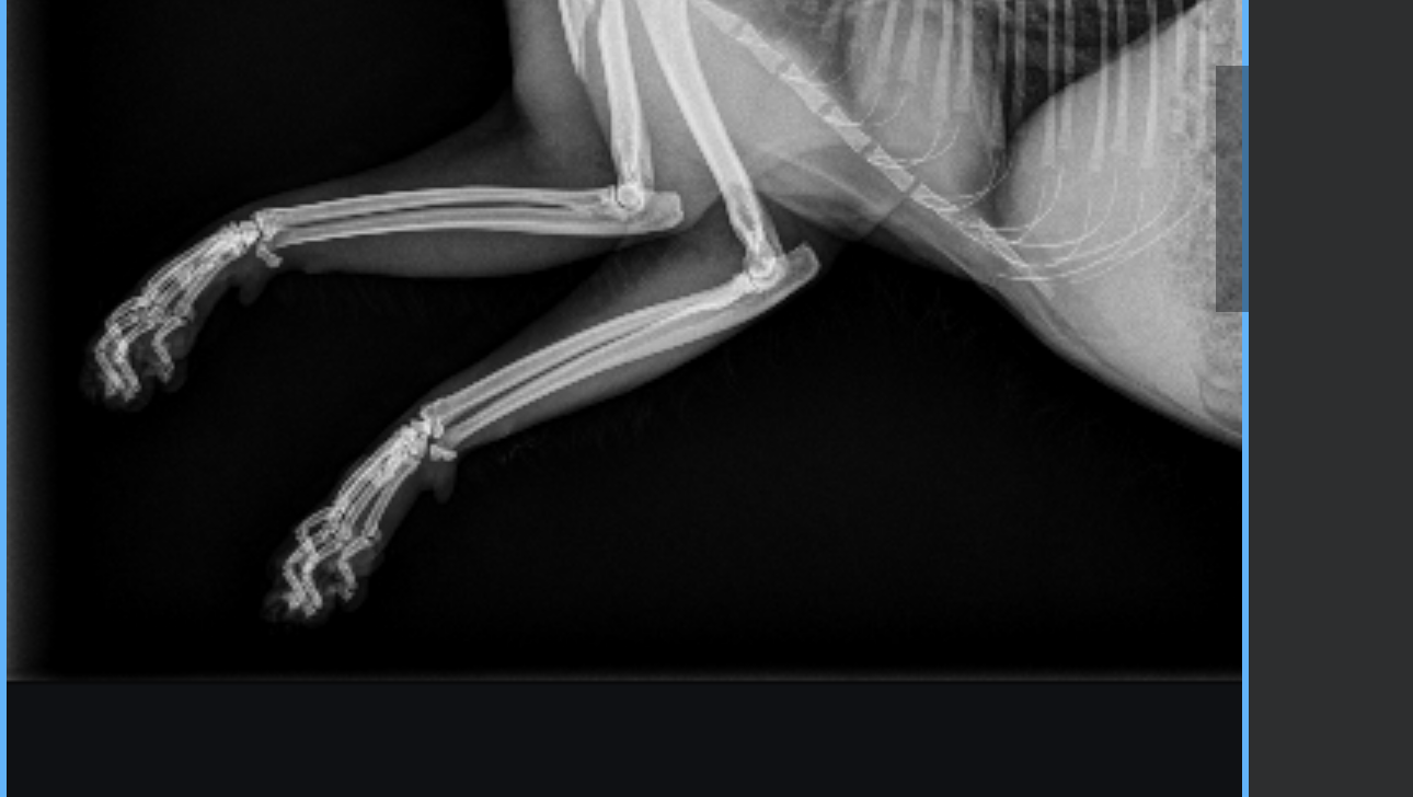 Support for Lil Baby’s Life-Saving Surgery photo