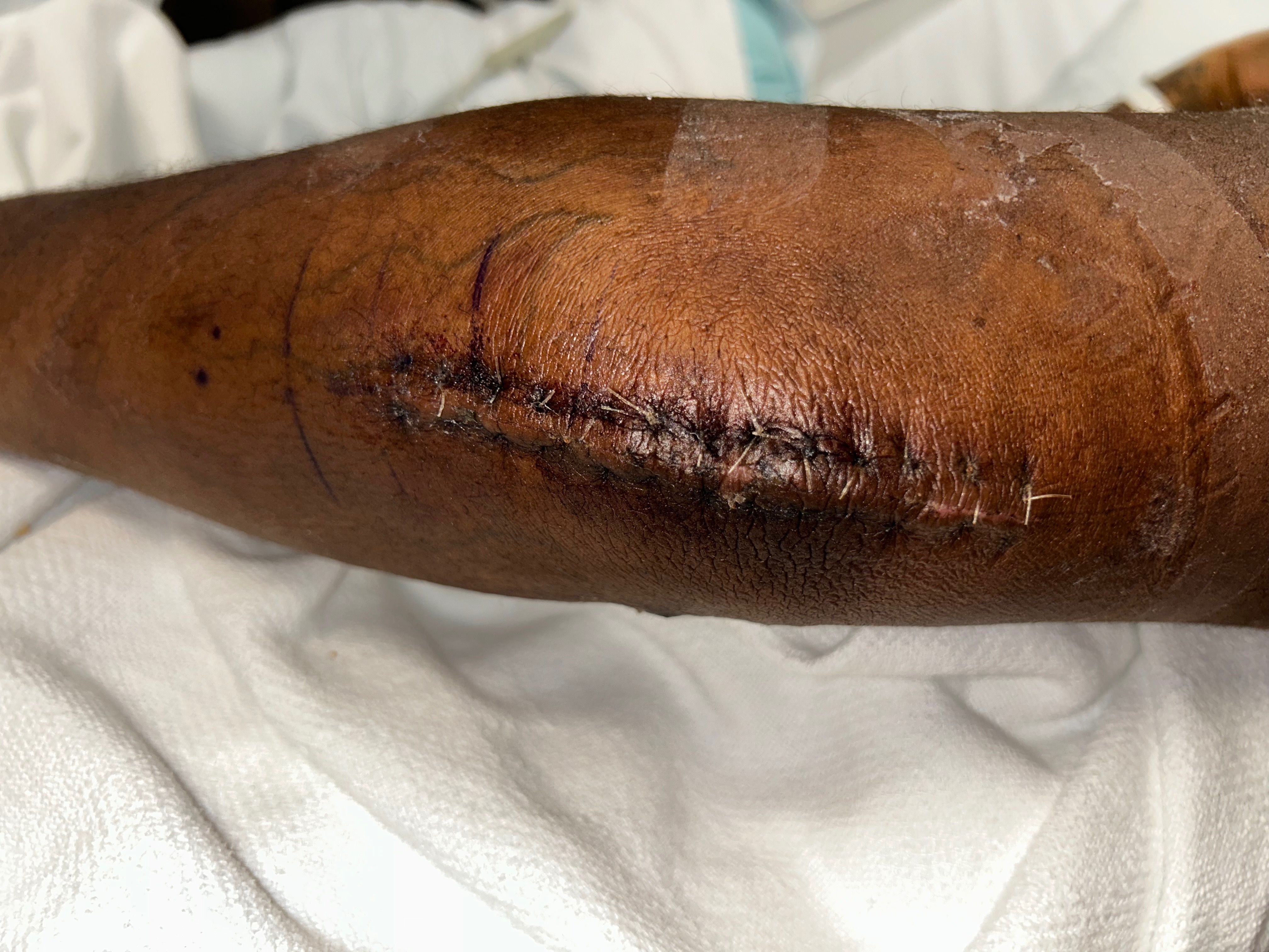 NY Republican Candidate Shot Three Times for Speaking Truth  campaign photo, 2 of 8