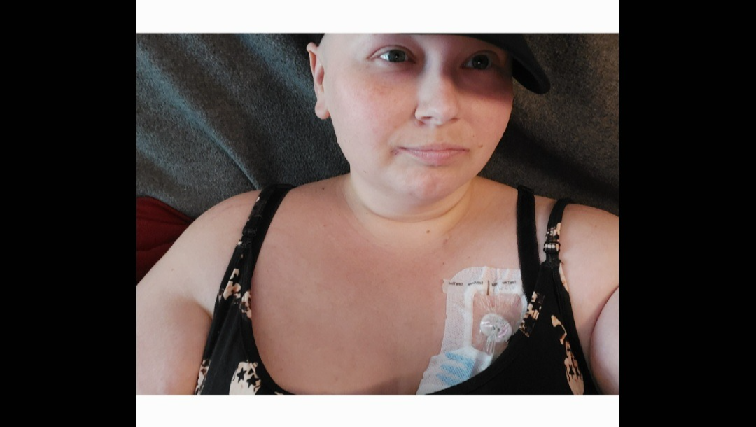 Holding On to Hope: A Cancer Journey That Isn’t Over Yet photo