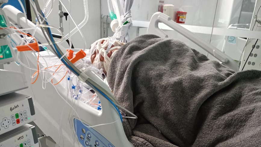 Me quemaron el 80  de mi cuerpo: hoy necesito tu ayuda photo