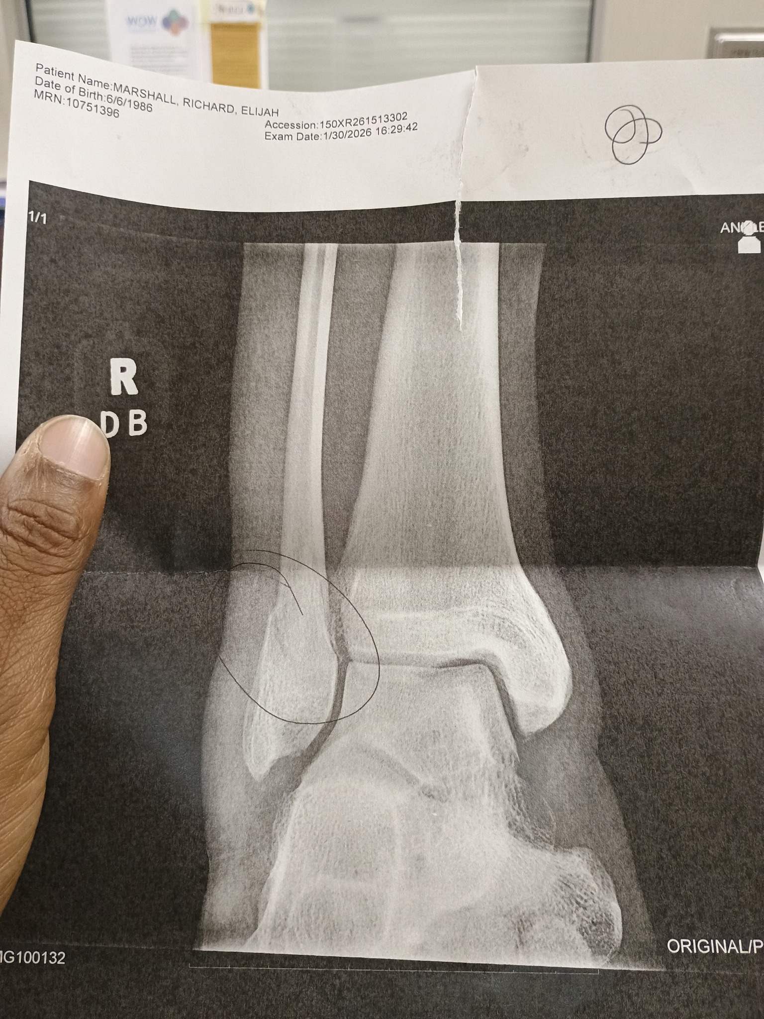 Support Richard's Recovery After Snowfall Injury campaign photo, 2 of 5