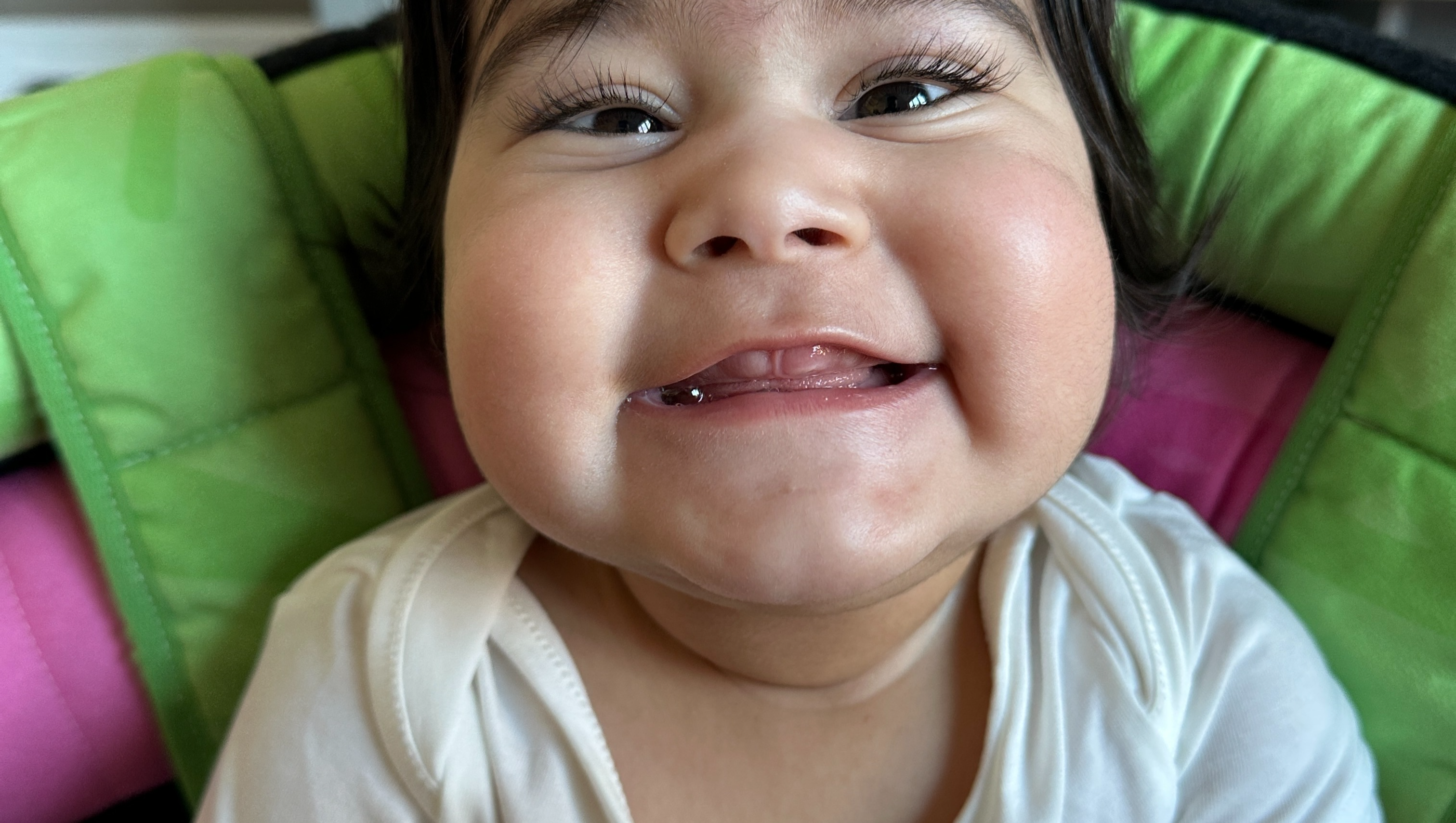 Eliyas needs life saving treatment photo