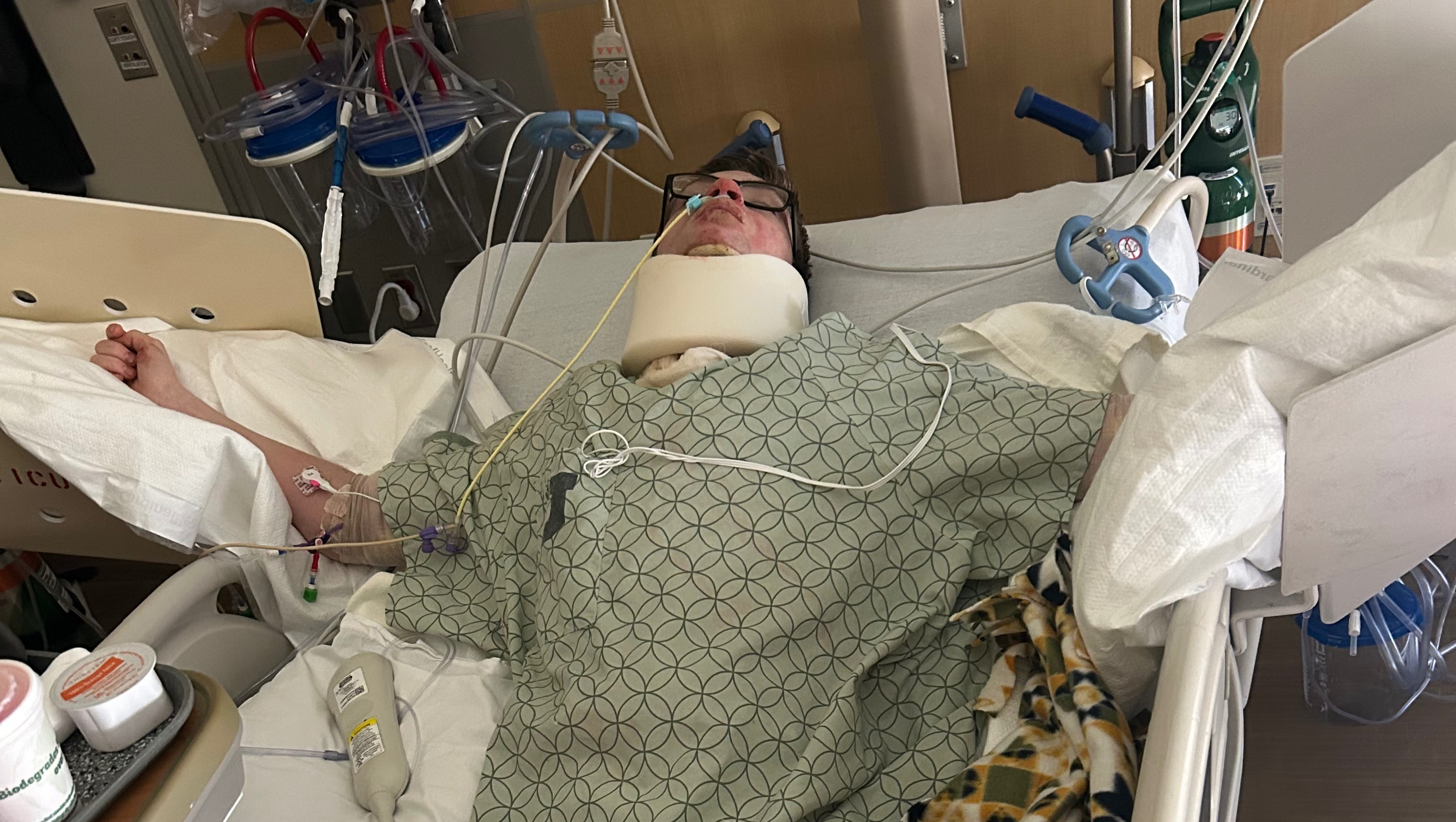 Support for Burn Recovery and Family Needs photo