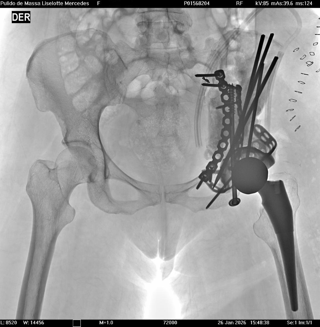 Help Lolo Recover After Emergency Hip & Pelvis Surgery campaign photo, 7 of 8