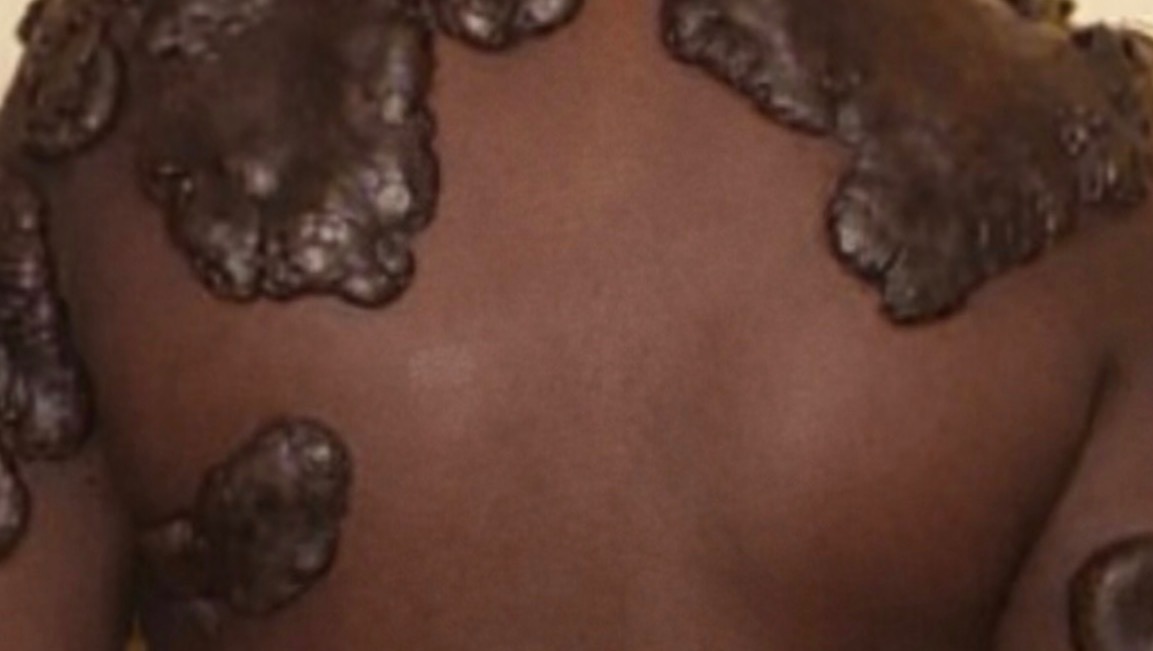 Support Jewel’s Journey to Pain-Free Living photo