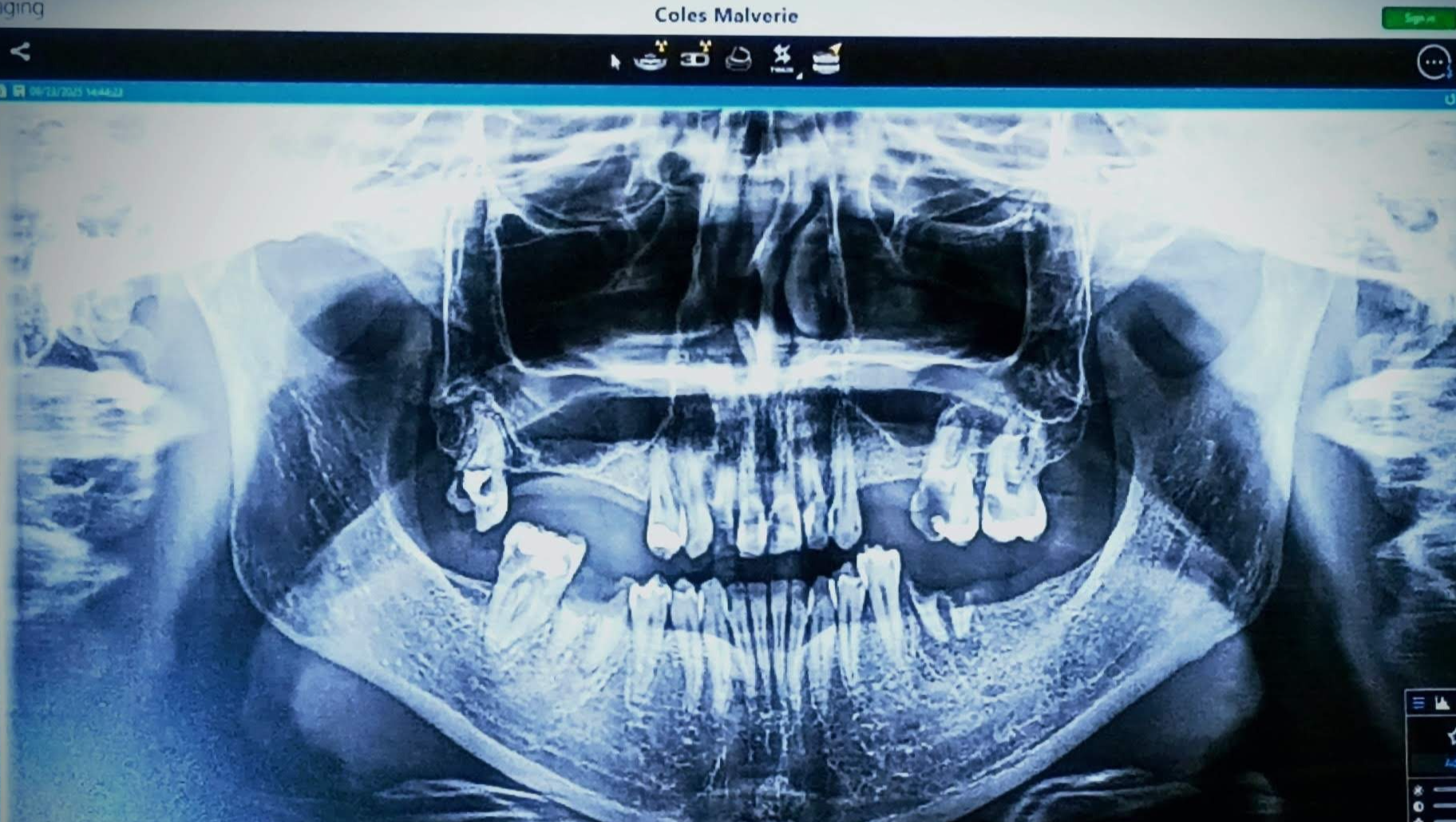 Help Malverie Get Life-Changing Dental Care photo