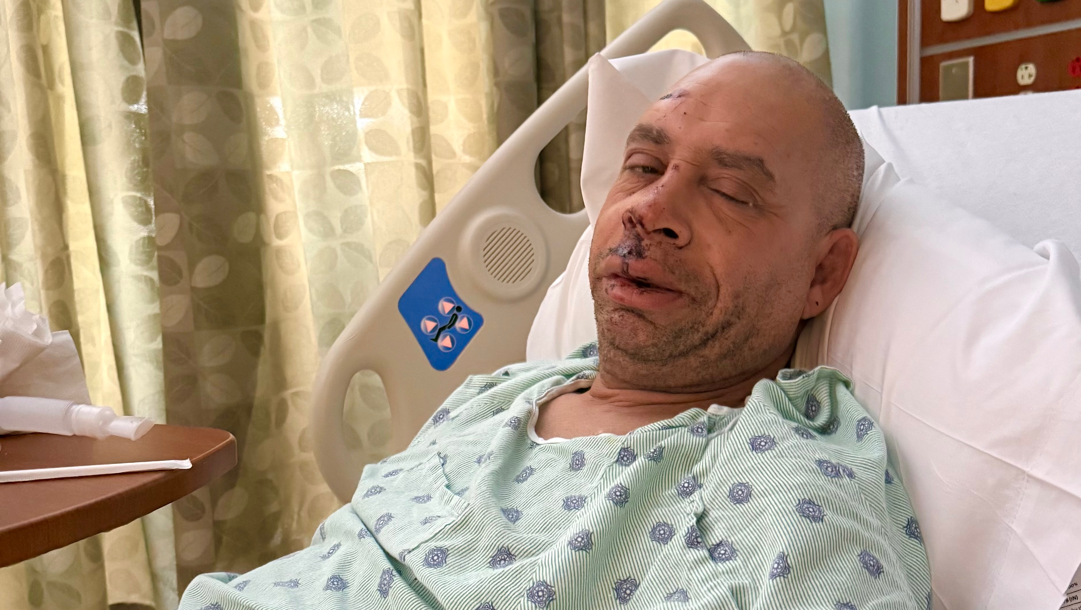 Support Michael Monterio’s Recovery Here In Detroit.