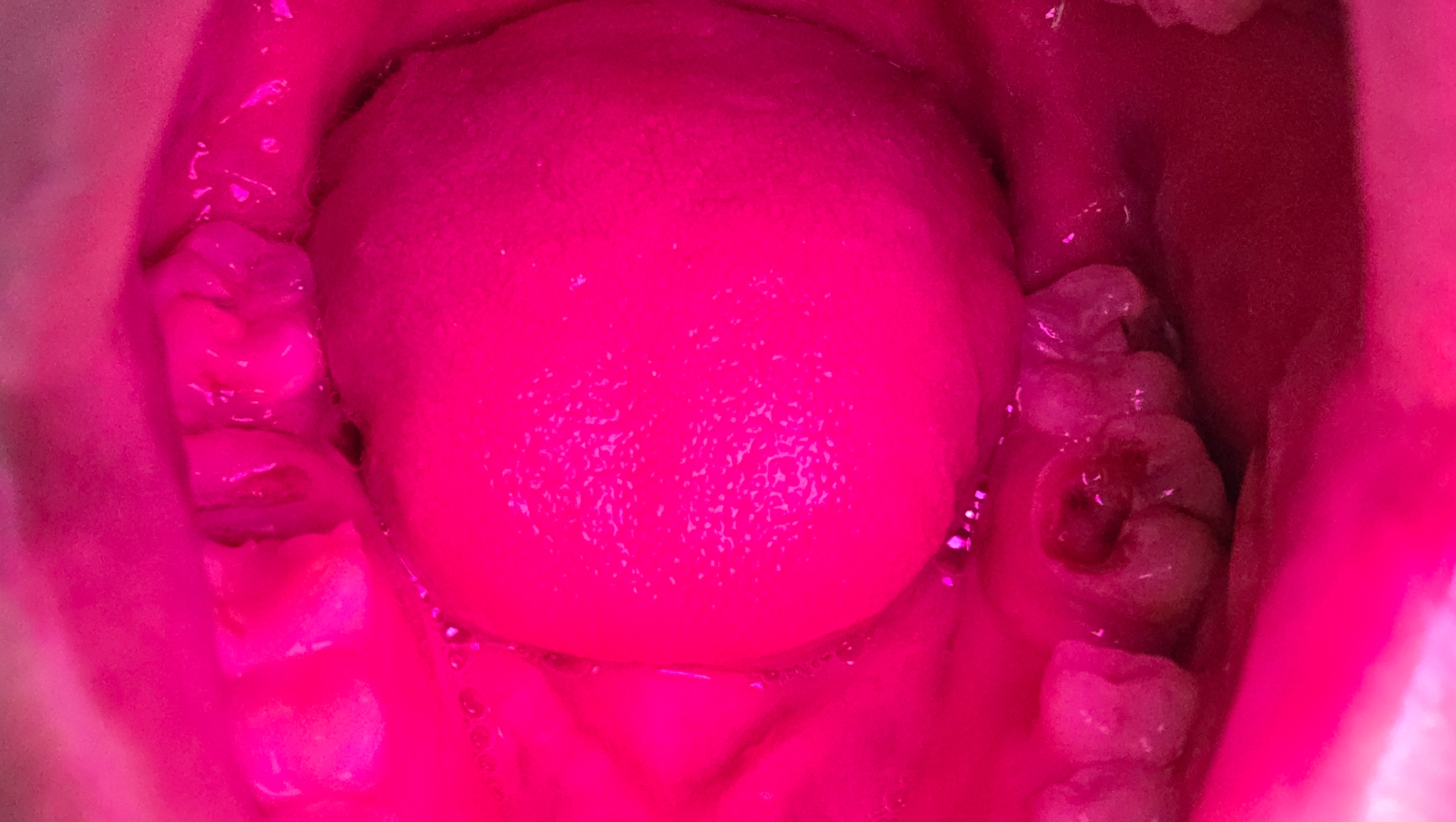 Help Ken Get Urgent Dental Care photo