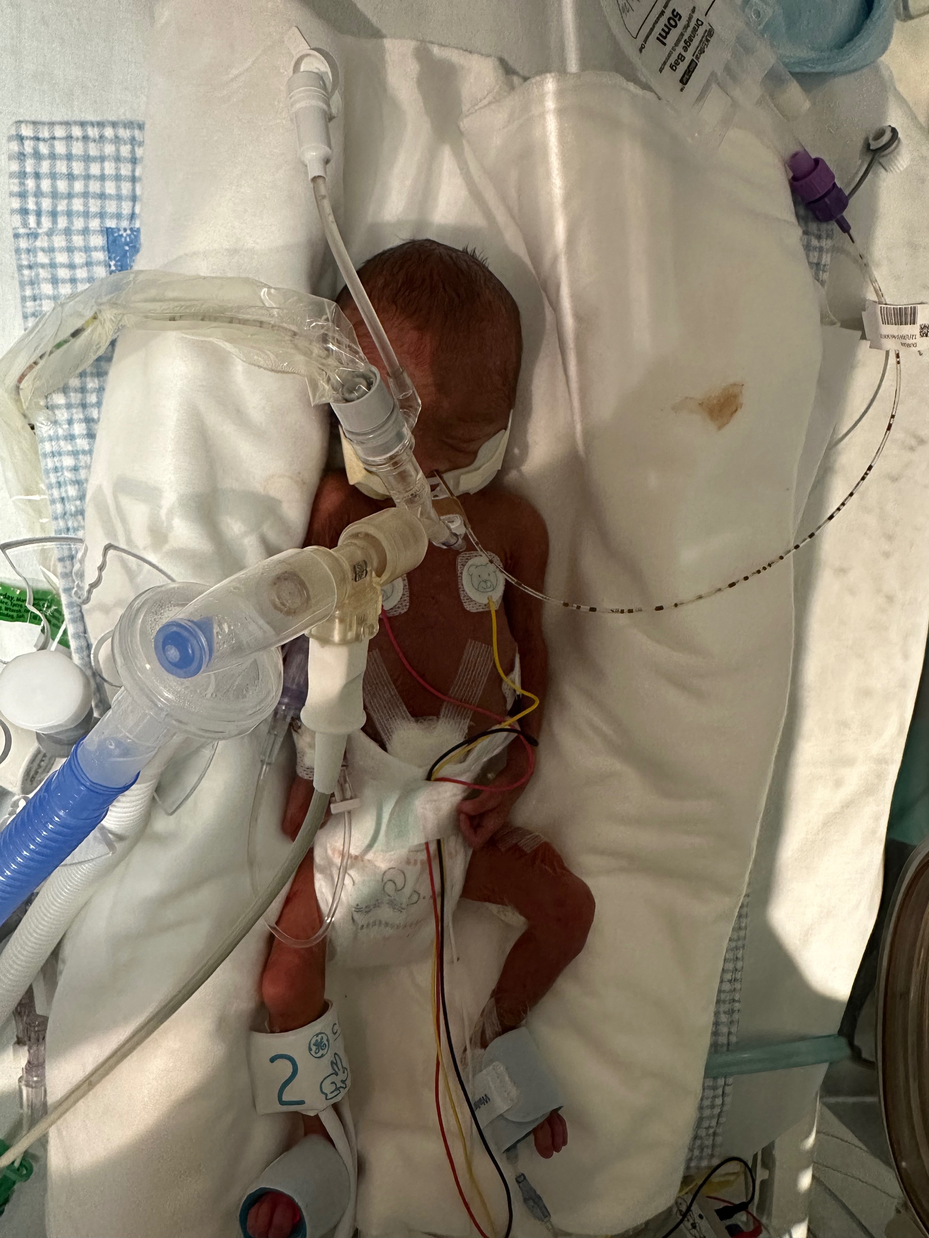 Supporting Our Family While Our Baby Boy Fights in NICU campaign photo, 6 of 7
