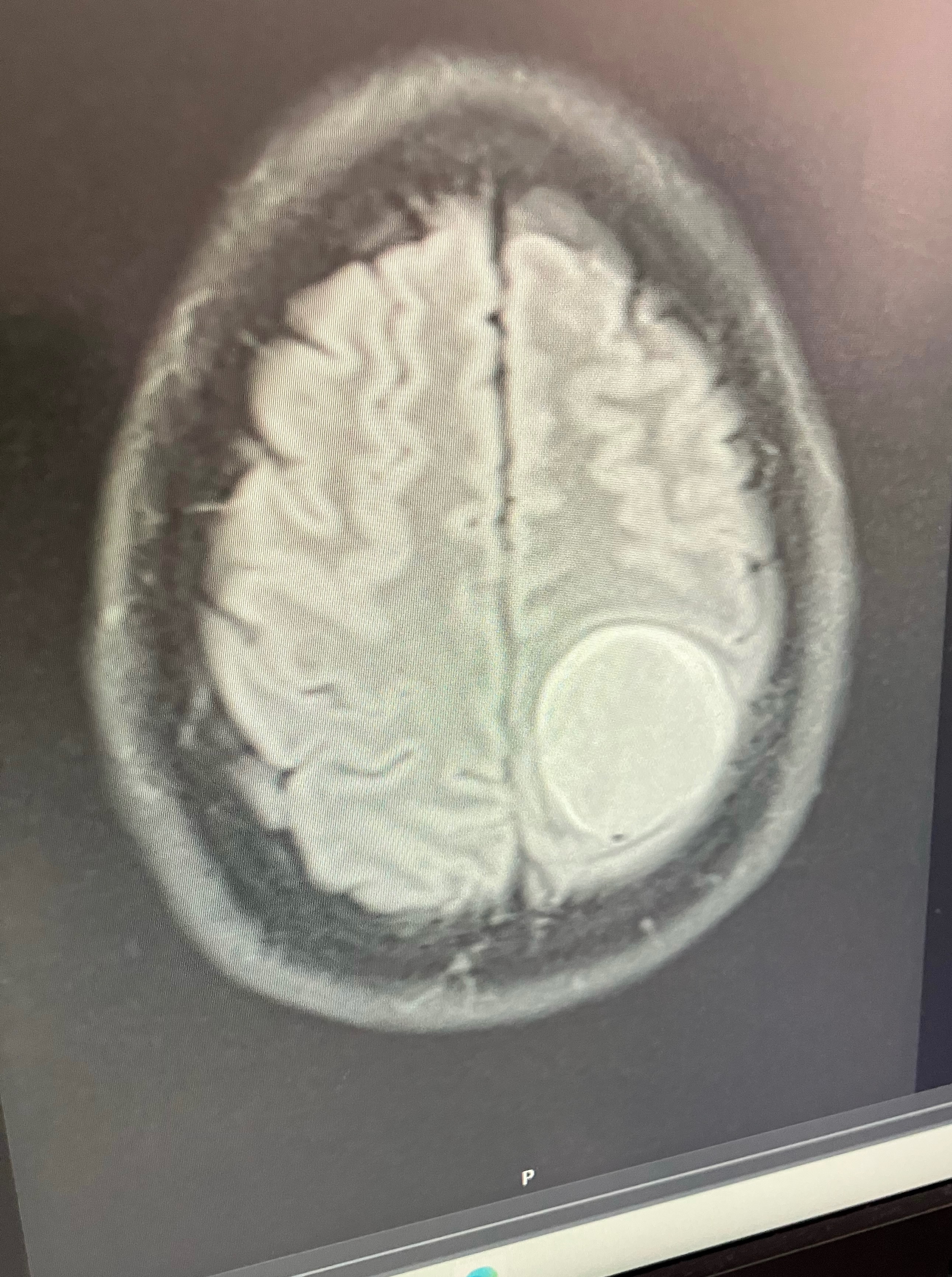 Support Tambra’s Brain Surgery Recovery campaign photo, 5 of 8