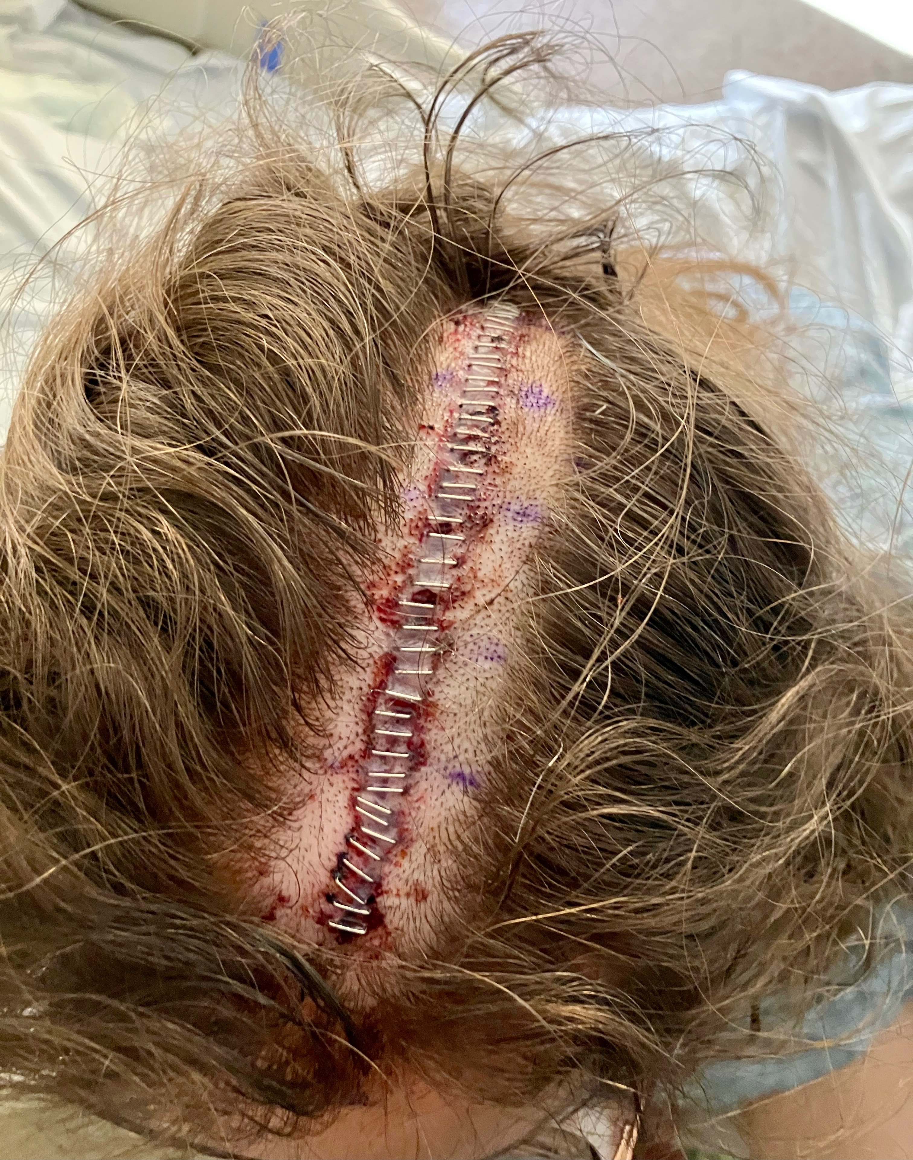 Support Tambra’s Brain Surgery Recovery campaign photo, 6 of 8