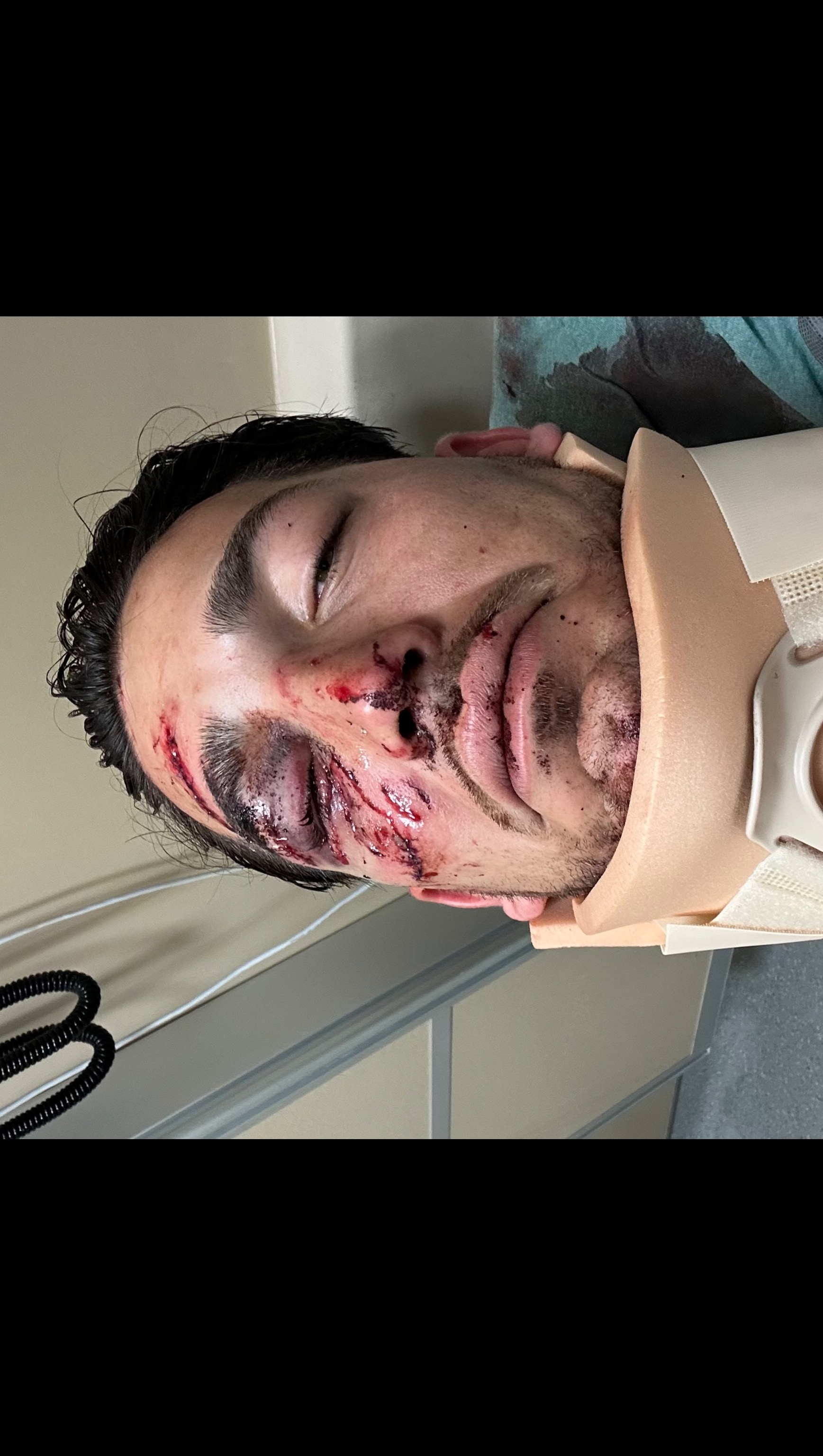 Help Bryan since his bad bike accident recover